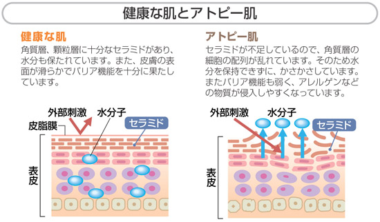 健康な肌とアトピー肌