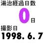 湯治経過日数0日