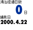 湯治経過日数0日