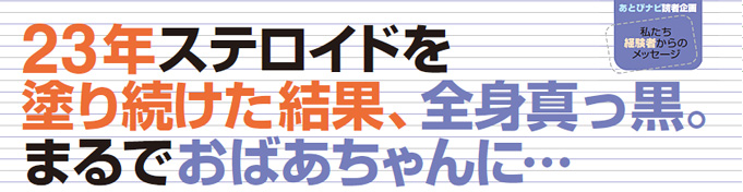 ステロイドがアトピーを悪化させていた